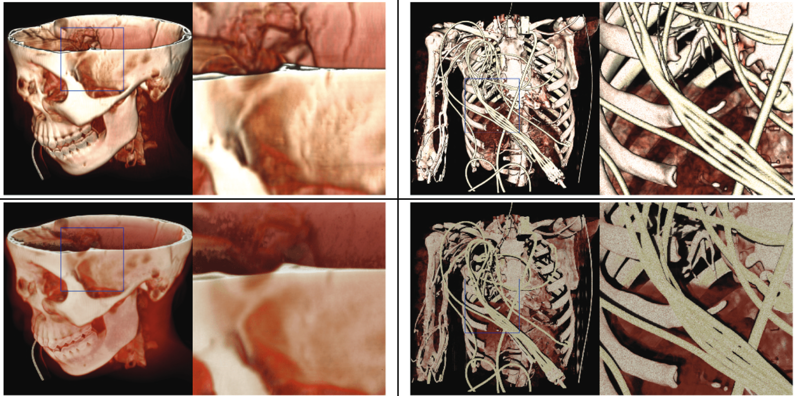 Featured image of post Interactive, in-browser cinematic volume rendering of medical images